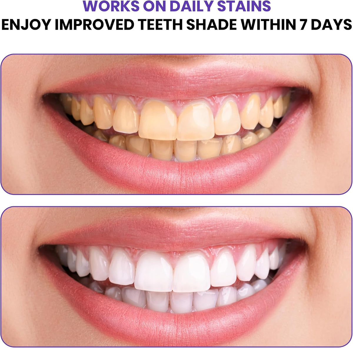 Close-up of Teeth Whitening Strips